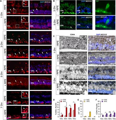 An in vitro Model of Human Retinal Detachment Reveals Successive Death Pathway Activations